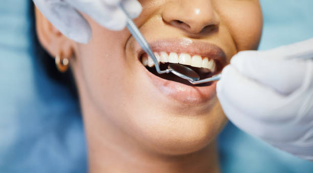 Best Dentist for Tooth Abscess  in Forsyth, MT