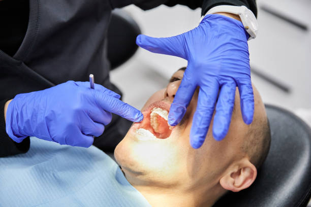 Best Tooth Pain Emergency Relief  in Forsyth, MT