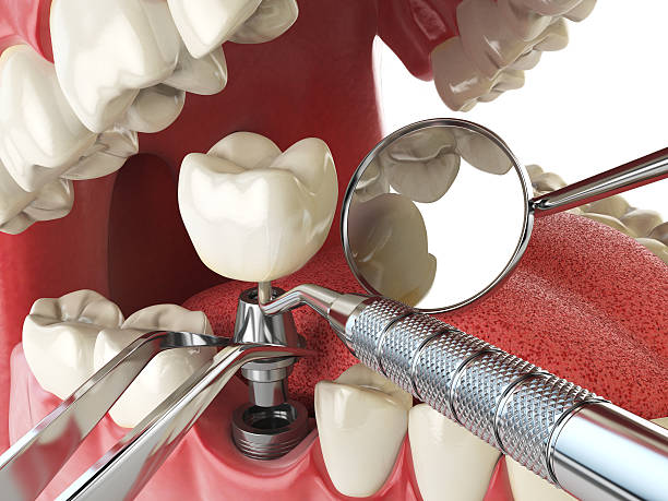 Best Emergency Dentist Near Me  in Forsyth, MT